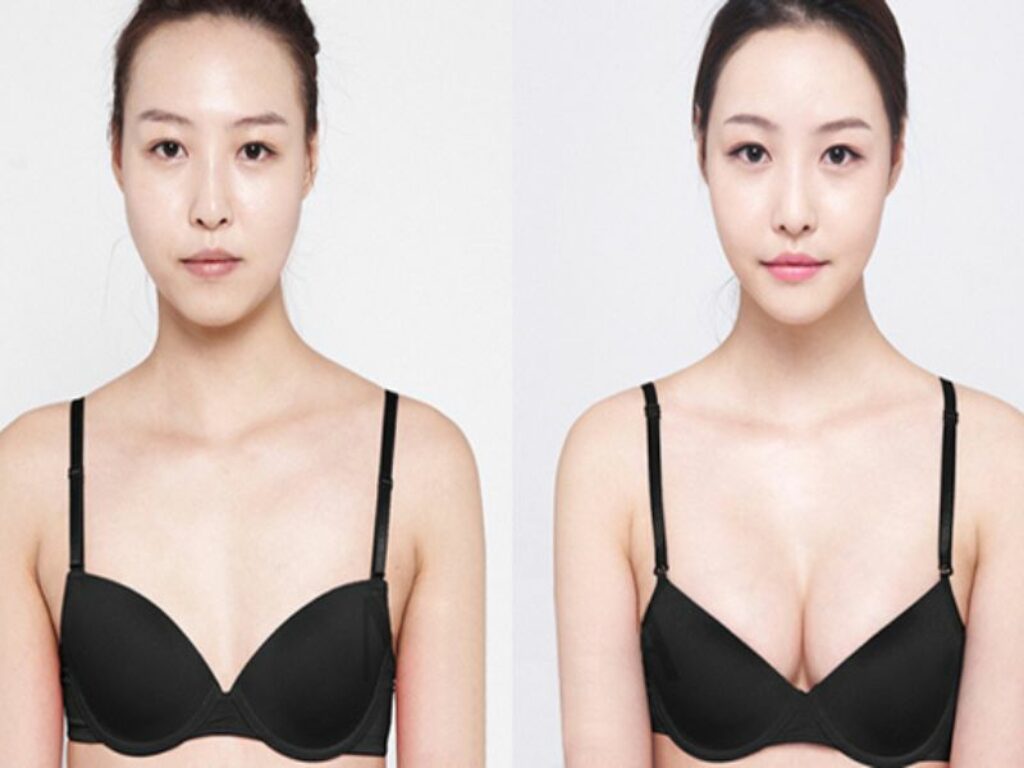 Viên uống tăng kích thước vòng 1 có thể gây hại không?