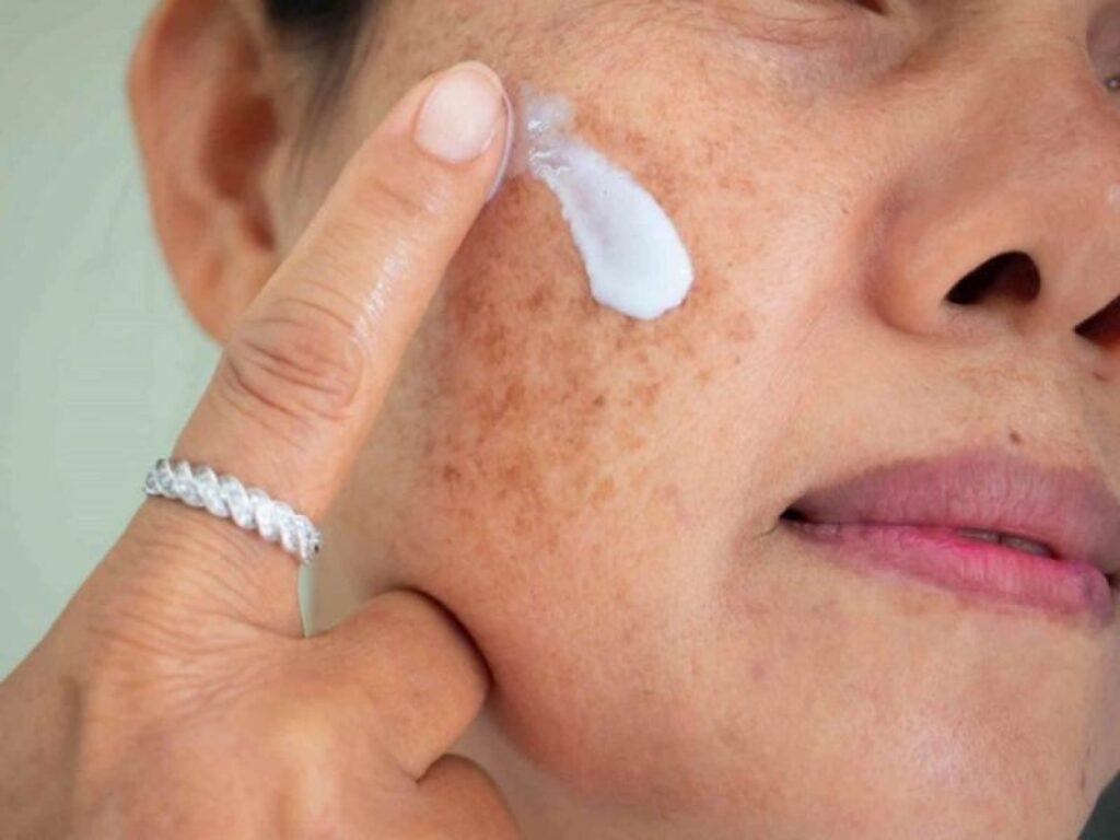Hướng dẫn cách chọn kem đặc trị nám đúng cách và hiệu quả