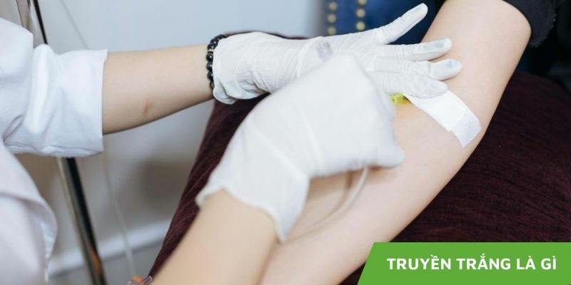 Truyền Trắng Là Gì? Tất Cả Những Gì Bạn Cần Biết Trước Khi Thực Hiện