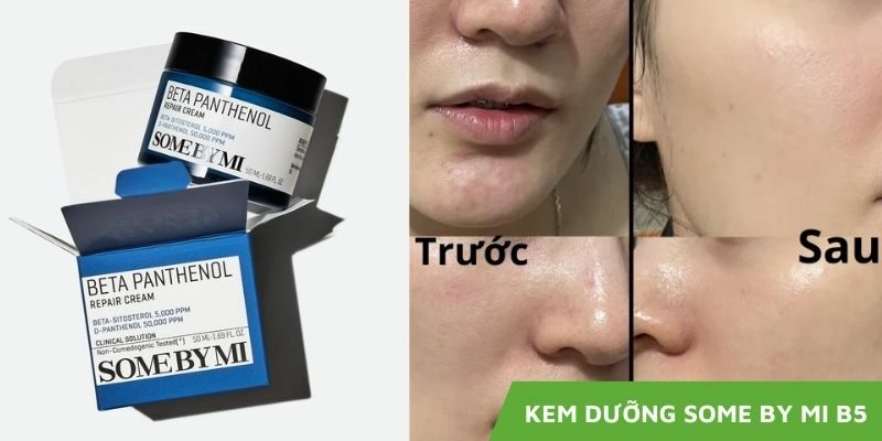 Review Kem Dưỡng Some By Mi B5 | Bí Quyết Chăm Sóc Da Tối Ưu